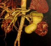 CT with 3D Reconstruction