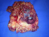 Specimen with Macroscopic Clear Margin - Right