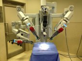 Da Vinci Robot at Waterfall Hospital